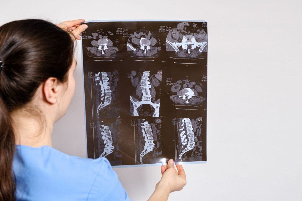 Porckorong kiboltosulás és előboltosulás